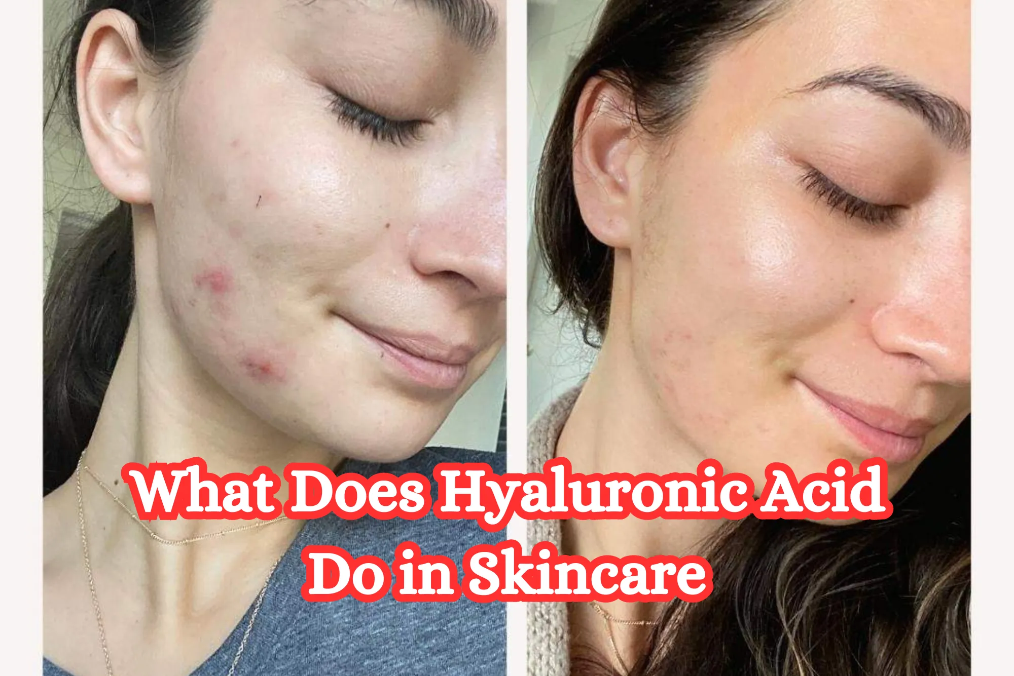 What Does Hyaluronic Acid Do in Skincare